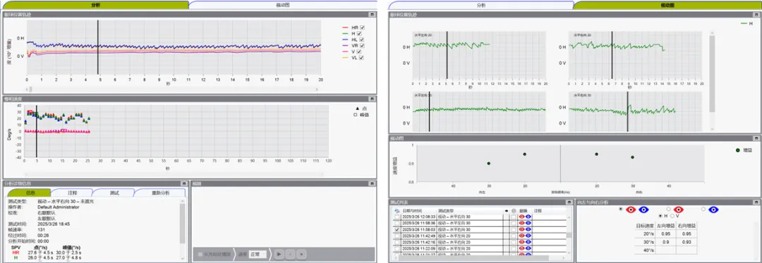 博闻 | VNG眼震视图检查（四）视动试验(图7)