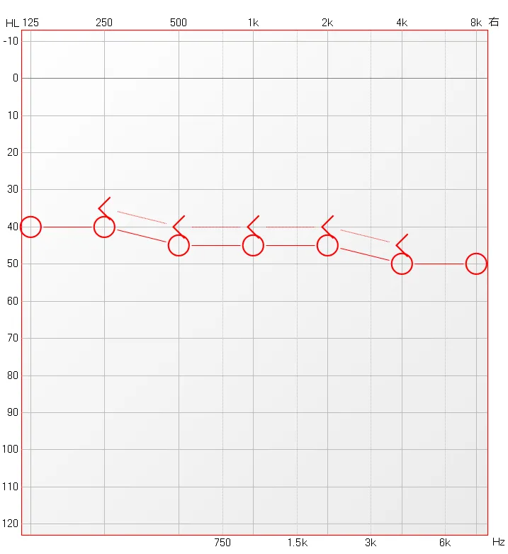 博闻 | 熬夜后耳鸣、听不清?警惕突发性耳聋!(图12) 博闻 | 熬夜后耳鸣、听不清?警惕突发性耳聋!(图12)