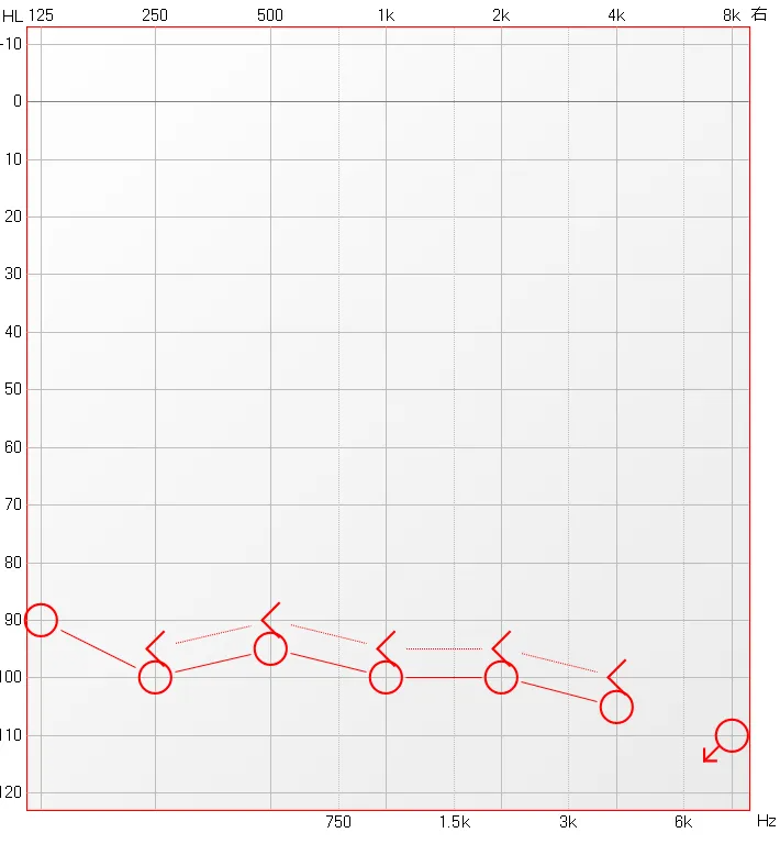 博闻 | 熬夜后耳鸣、听不清?警惕突发性耳聋!(图13) 博闻 | 熬夜后耳鸣、听不清?警惕突发性耳聋!(图13)